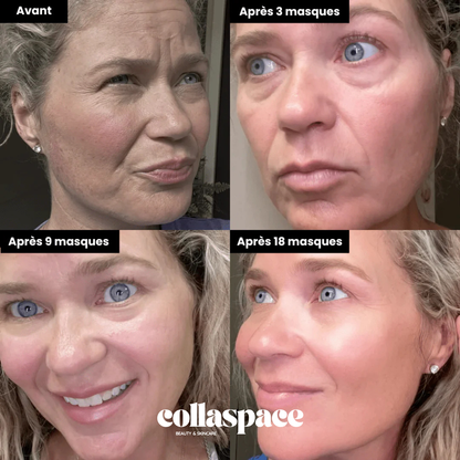 CollaMask™ – Masque au Collagène BIO